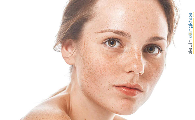 lá chùm ngây trị nám da, tàn nhang hiệu quả