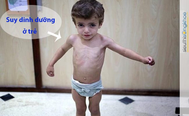 công dụng trị nám da của lá chùm ngây