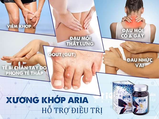 CÓ AI DÙNG XƯƠNG KHỚP ARIA CHƯA - đối tượng sử dụng