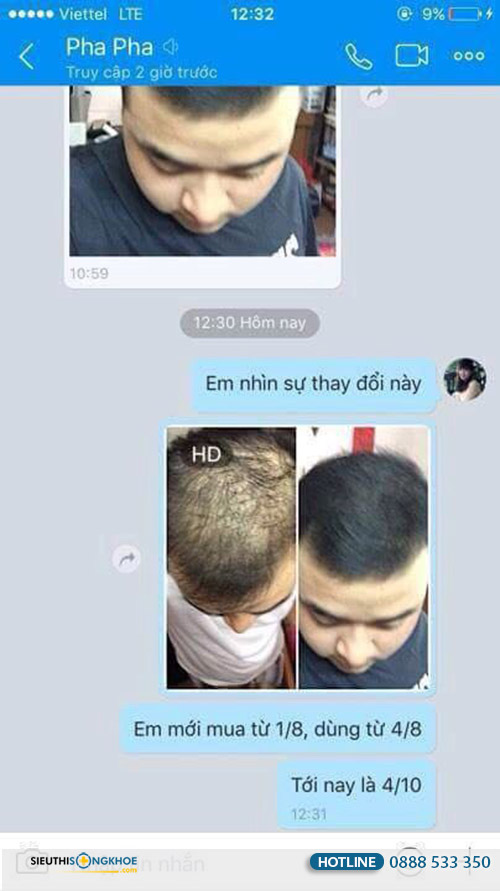 phản hồi khách hàng dùng tóc mộc linh