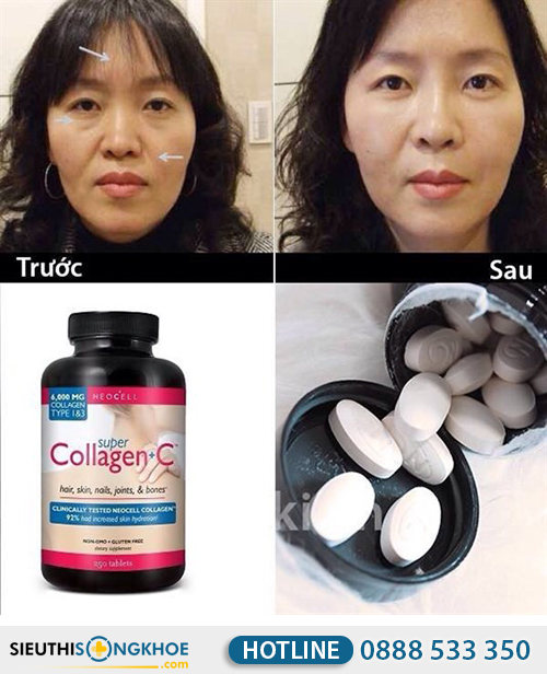 review vien-uong-bo-sung-neocell-super-collagen-c-type-1-3