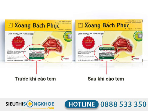 xoang bach phuc