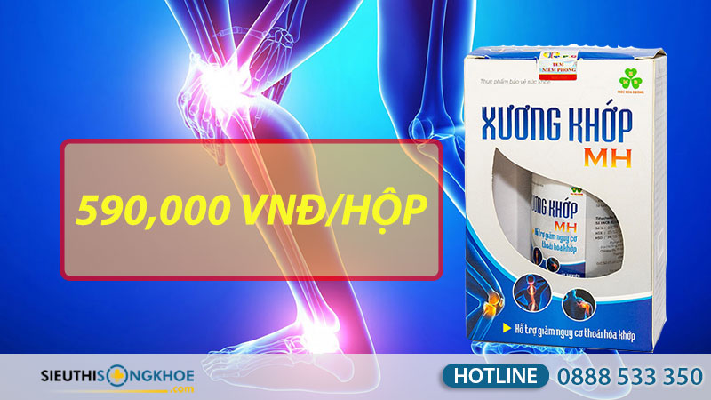 xương khớp mh giá bao nhiêu