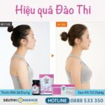 Bộ Sản Phẩm Nở Ngực Đào Thi (uống + kem bôi) - Hỗ Trợ Tăng Kích Thước Vòng Một Săn Chắc, Tự Nhiên