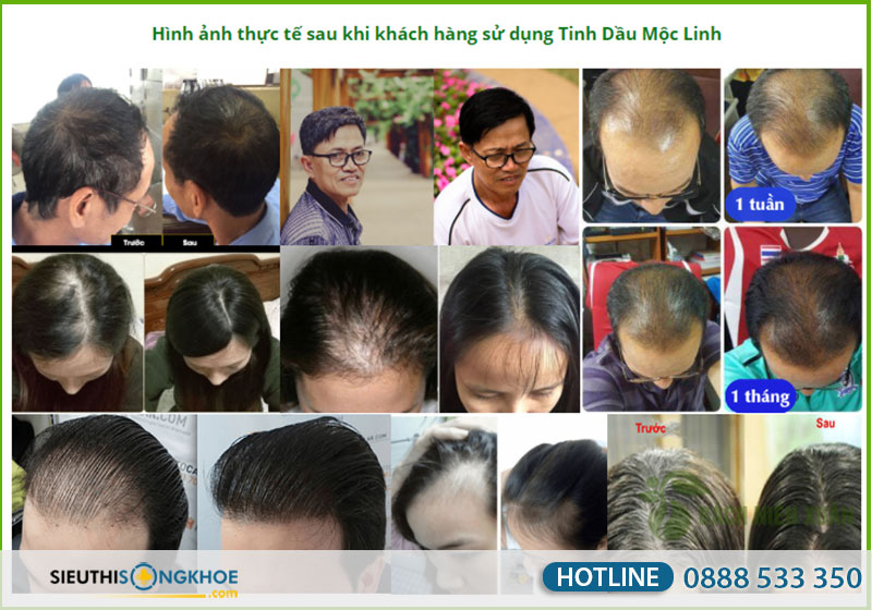 phản hồi của khách hàng về tóc mộc linh