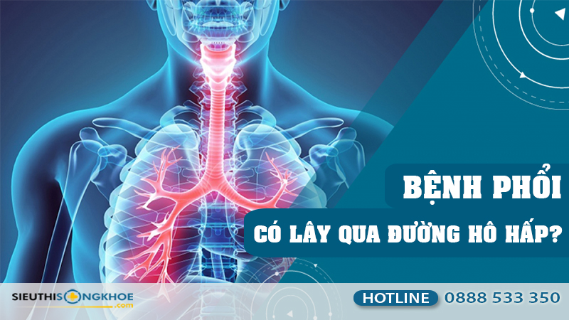 bệnh phổi có lây qua đường hô hấp