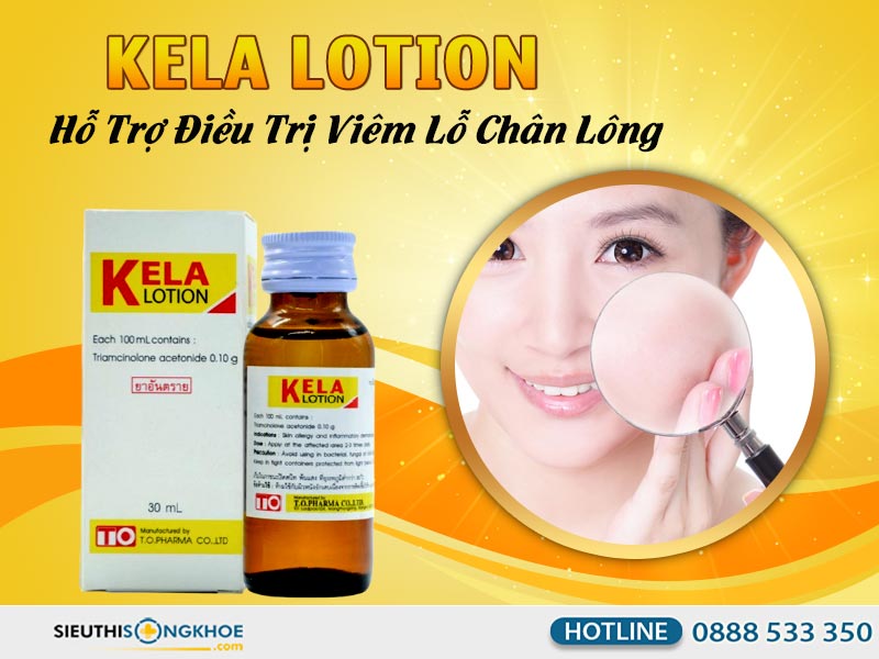 dung dich ho tro tri viem lo chan long kela lotion