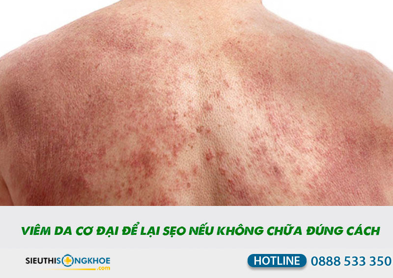 kem mỡ đa năng levomekol