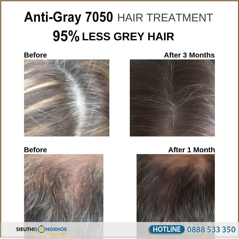 viên uống hỗ trợ điều trị tóc bạc sớm Anti Gray Hair 7050 có tốt không? Giá bao nhiêu? Mua ở đâu?