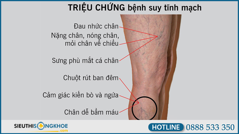 hinh-anh-nano-rutin-1