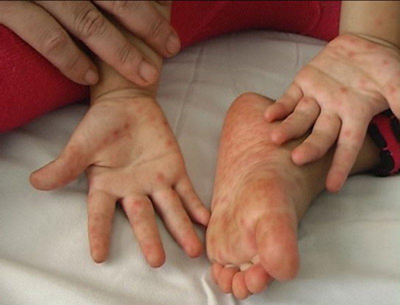 Kiêng tắm cho trẻ bị ốm có cần thiết không?