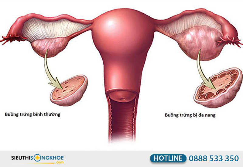 đối tượng sử dụng sản phẩm