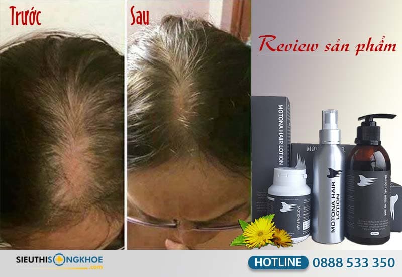 review bộ sản phẩm