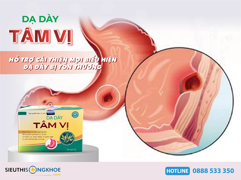 dạ dày tâm vị