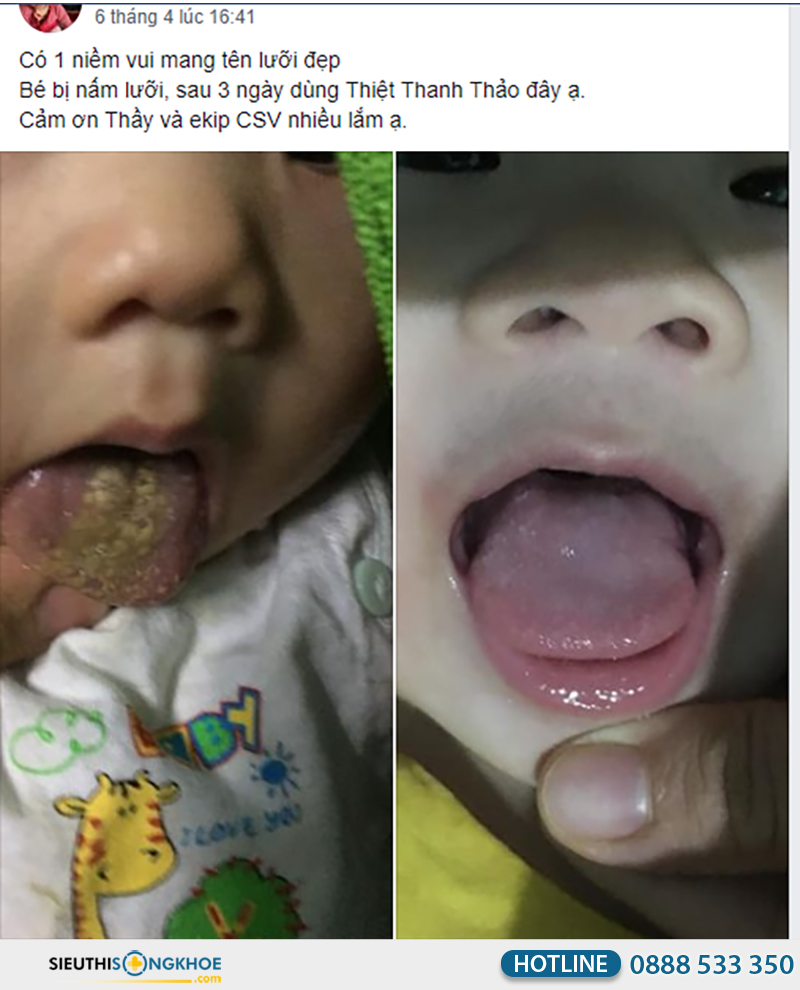 phản hồi khách hàng về thiệt thanh thảo