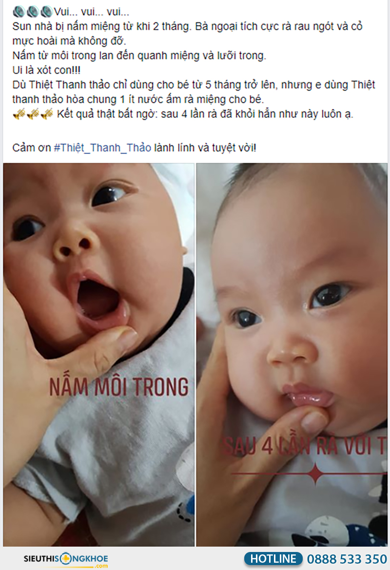 phản hồi khách hàng về thiệt thanh thảo