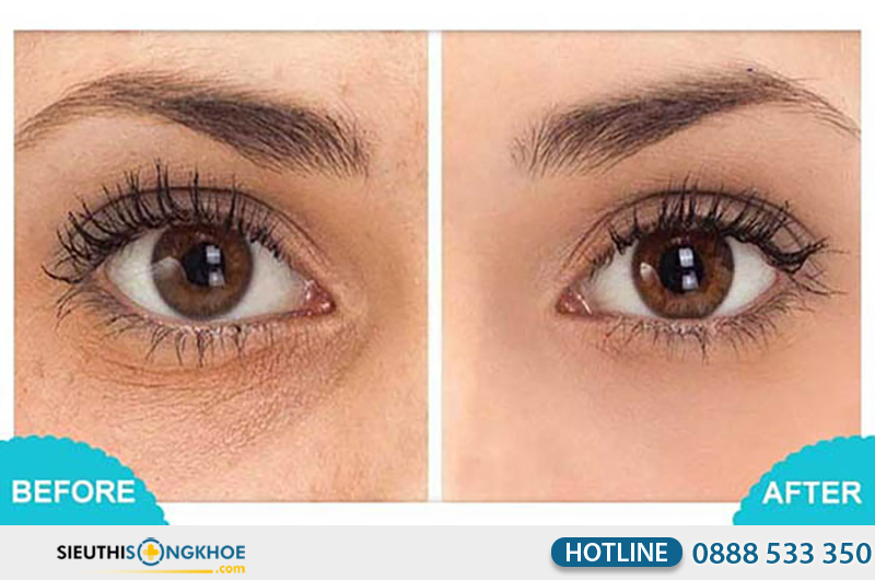 phản hồi khách hàng về obagi professional c eye brightener serum