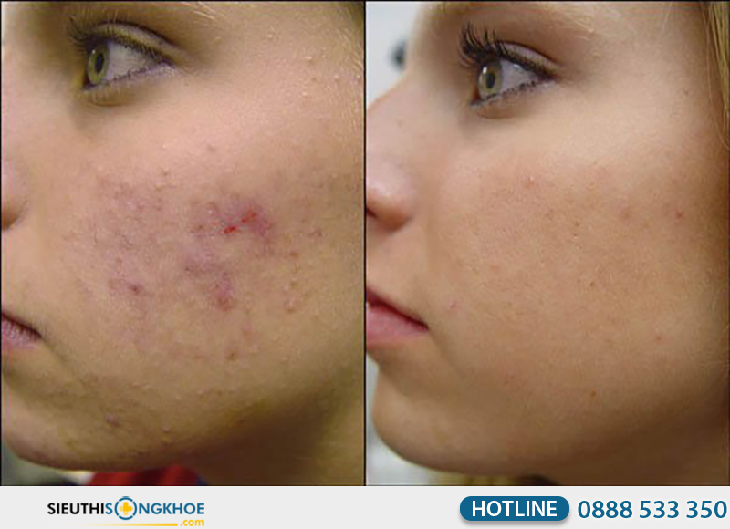 phản hồi khách hàng về obagi professional c serum 15%