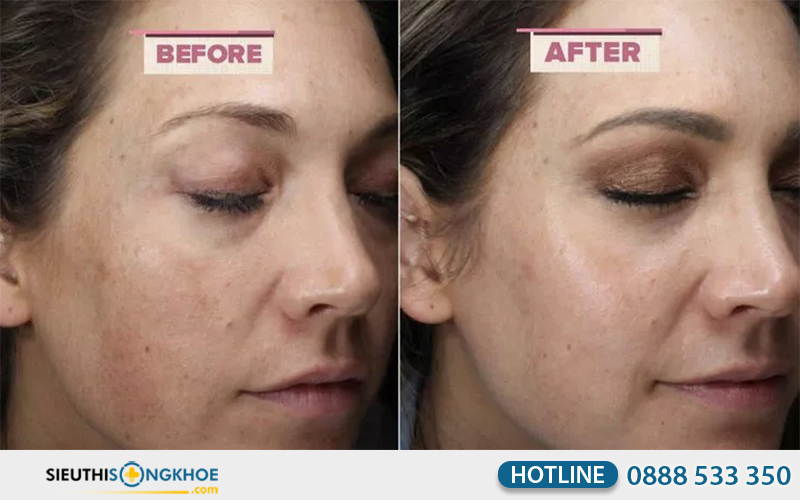 phản hồi khách hàng về obagi professional c serum 15%