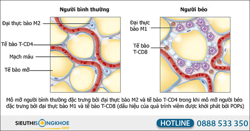 mô hình mỡ thừa
