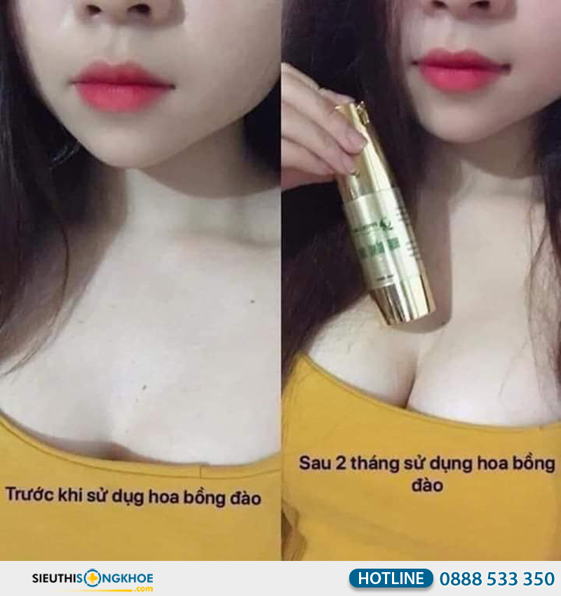 phản hồi khách hàng về sản phẩm hoa bồng đào