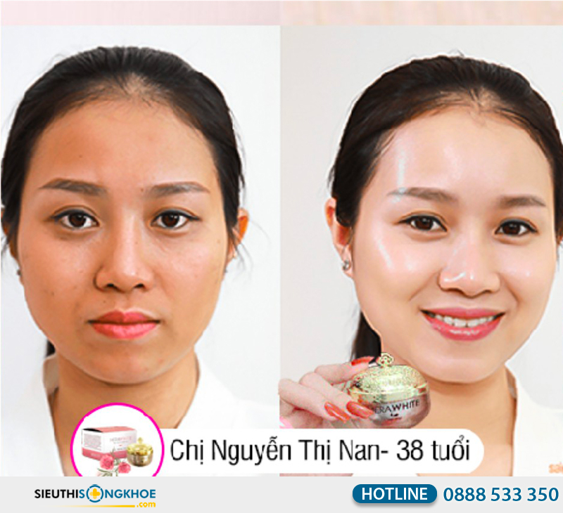 phản hồi khách hàng về merawhite night