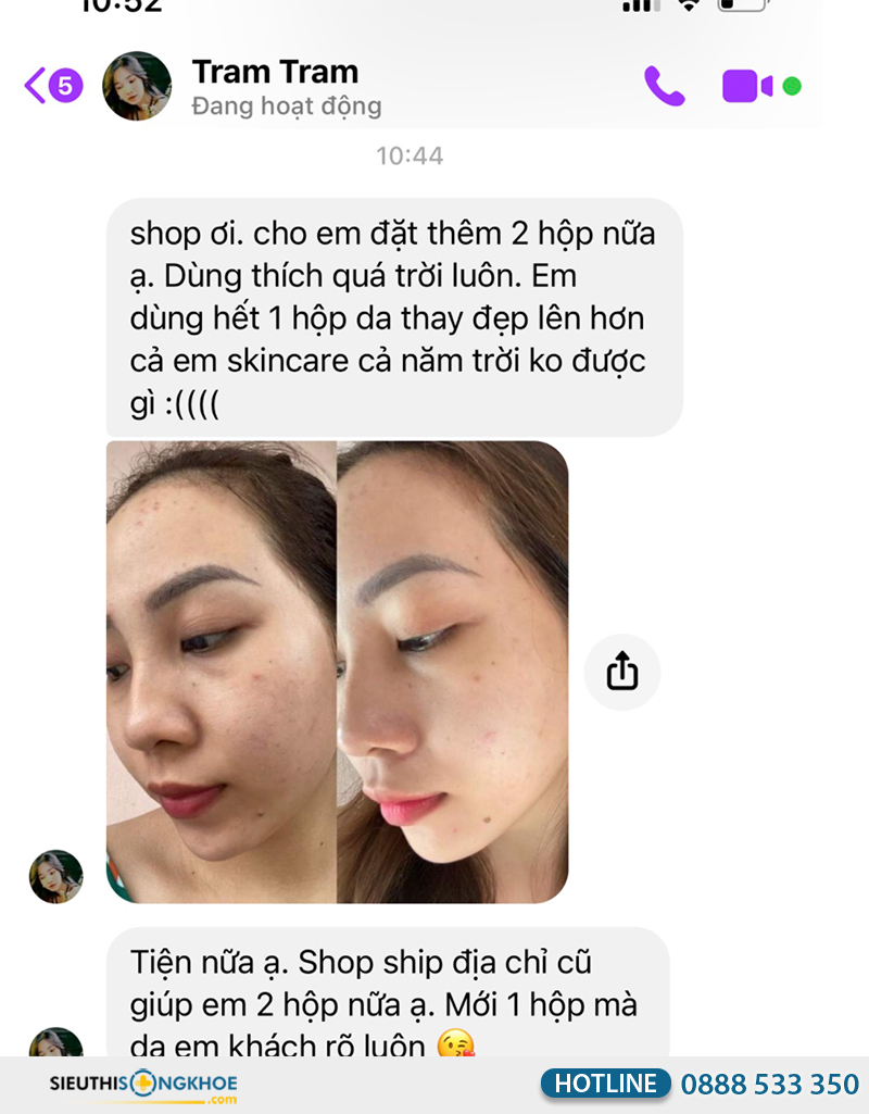 phản hồi khách hàng về collagen comi