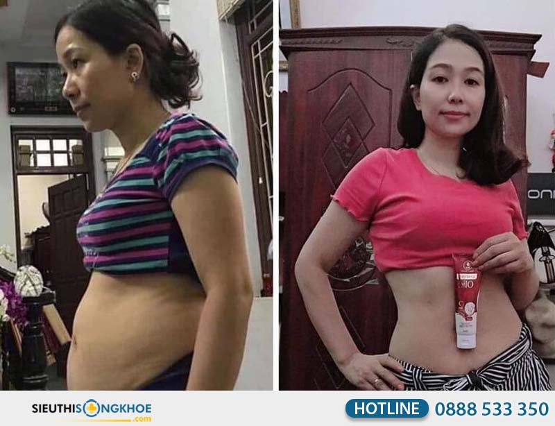 phản hồi sử dụng kem quế olic từ khách hàng