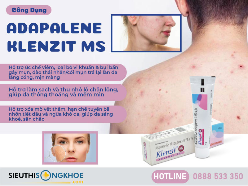 công dụng adapalene klenzit ms