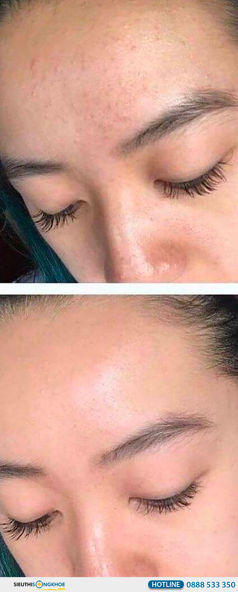 phản hồi khách hàng klenzit ms