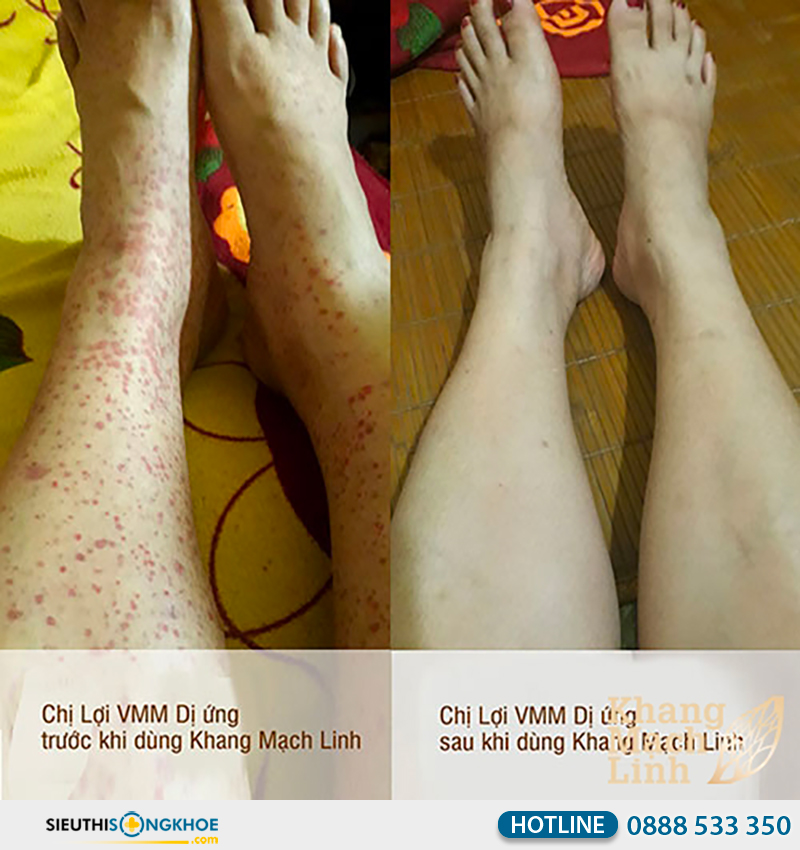 phản hồi khách hàng của khang mạch linh