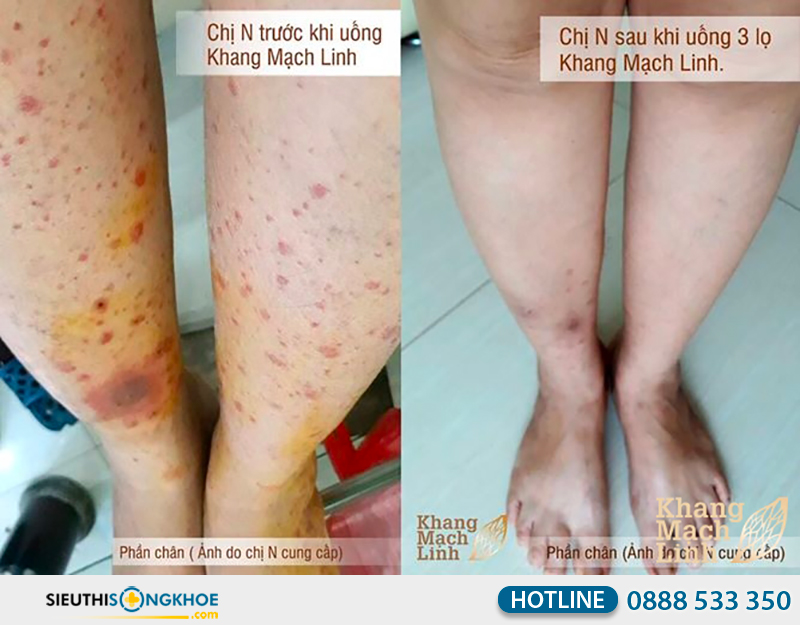 phản hồi khách hàng về khang mạch linh