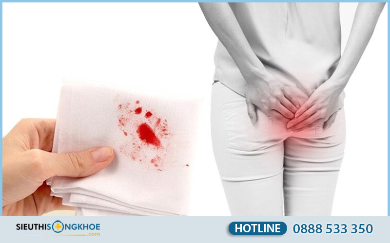 Viên sủi Satuchin hỗ trợ điều trị trĩ Có Tốt Không