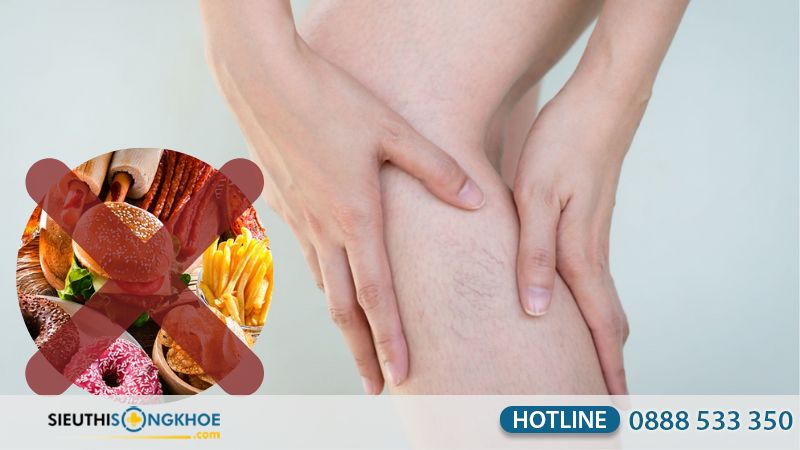 Giãn tĩnh mạch kiêng ăn gì