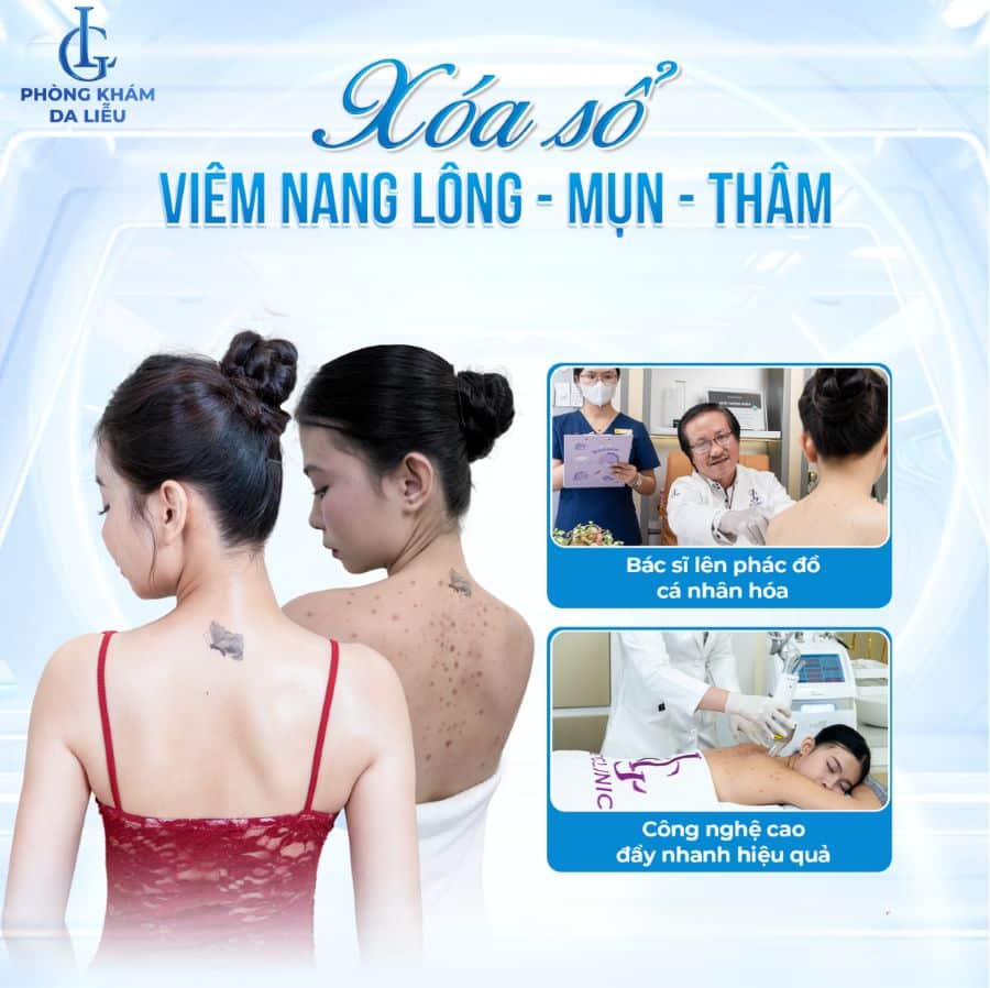 Phòng khám Da liễu LG nổi bật với công nghệ trị mụn lưng độc quyền, hiệu quả và an toàn tuyệt đối